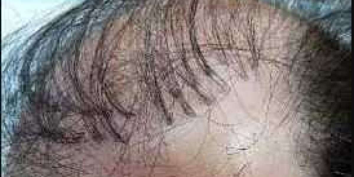 Article Picture
